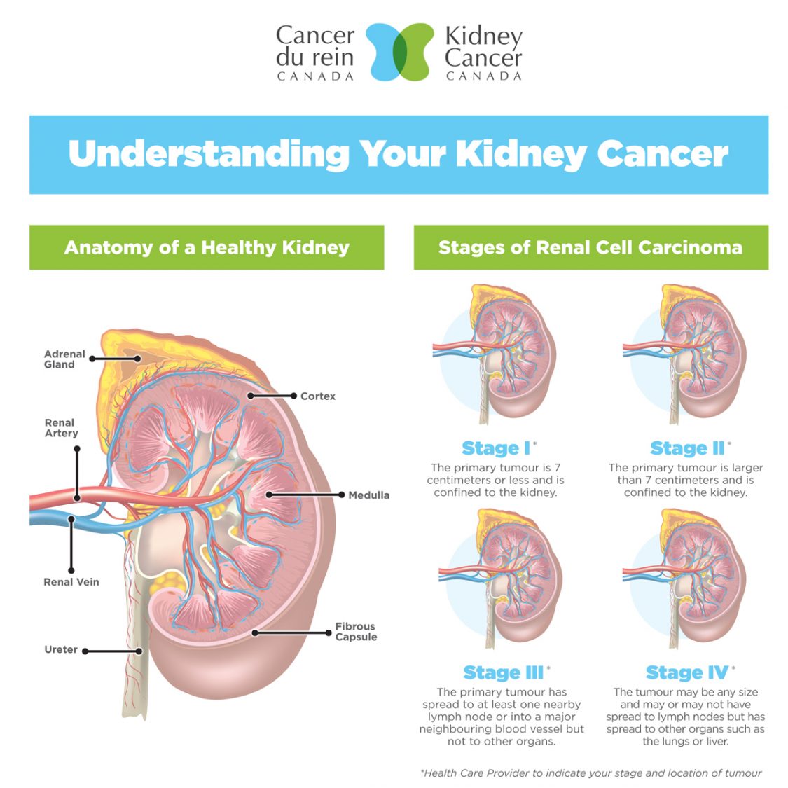 Main Home | Kidney Cancer Canada